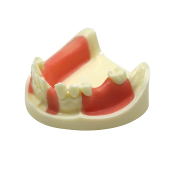 Dantų Apatinio Žandikaulio Implantas Praktikos Modelis Gingiva su Trūkstamus Dantis Odontologo Švietimo Dantų Praktika Modelis Dantų Prekes
